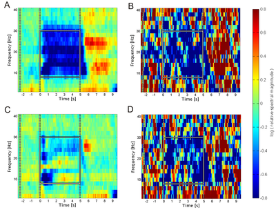 median vs. single trial EEG data