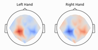 Braindecode: Deep learning toolbox for EEG