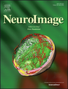 Article selected as cover of NeuroImage 128